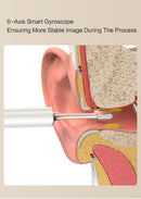 NETTOYEUR D'OREILLES T15 WINKOO POUR CÉRUMEN ET ACNÉ NETTOYAGE DES OREILLES DES OREILLES AVEC APPAREIL PHOTO